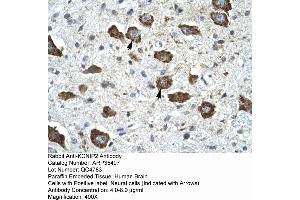 Human Brain (KCNIP2 antibody  (N-Term))