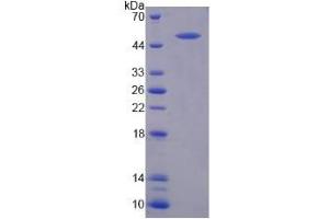 Image no. 1 for Von Willebrand Factor (VWF) (AA 34-240) protein (His tag,GST tag) (ABIN4988534)