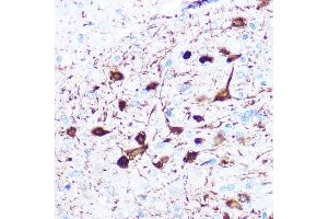 Immunohistochemistry of paraffin-embedded rat brain using gamma-Synuclein Rabbit mAb (ABIN3016563, ABIN3016564, ABIN1680688 and ABIN1680689) at dilution of 1:100 (40x lens). (SNCG antibody)