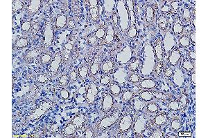 Formalin-fixed and paraffin embedded rat kidney labeled with Anti-AQP5 Polyclonal Antibody, Unconjugated (ABIN731258) followed by conjugation to the secondary antibody and DAB staining (Aquaporin 5 antibody  (AA 201-265))