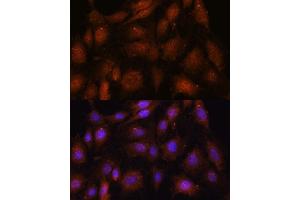 Immunofluorescence analysis of C6 cells using NOB1 antibody (ABIN7270109) at dilution of 1:100. (NOB1 antibody  (AA 1-230))