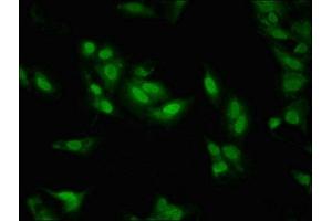 Immunofluorescent analysis of Hela cells using ABIN7158369 at dilution of 1:100 and Alexa Fluor 488-congugated AffiniPure Goat Anti-Rabbit IgG(H+L) (LIM Domain Binding 1 Protein antibody  (AA 50-375))