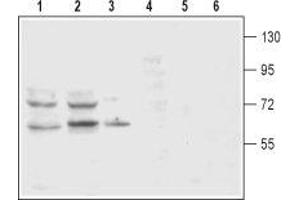 Western blot analysis of rat (lanes 1 and 4) and mouse (lanes 2 and 5) brain membranes and rat pheochromocytoma PC12 (lanes 3 and 6) cell lysates: - 1-3. (SLC6A3 antibody  (2nd Extracellular Loop))