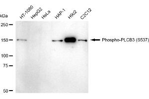 Western blotting analysis using Phospho-PLCB3 (S537) antibody (ABIN7799822).