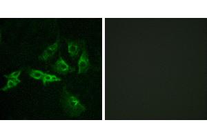 Peptide - +Immunofluorescence analysis of A549 cells, using GNRHR antibody. (GNRHR antibody  (Internal Region))
