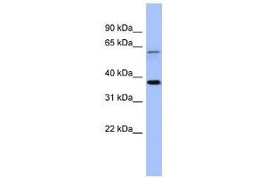 MAGEB1 antibody used at 1 ug/ml to detect target protein. (MAGEB1 antibody  (Middle Region))