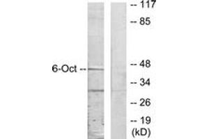 Western blot analysis of extracts from A549 cells, using OCT6 Antibody. (POU3F1 antibody  (AA 311-360))
