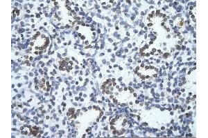 Rabbit Anti-PHF17 Antibody       Paraffin Embedded Tissue:  Human alveolar cell   Cellular Data:  Epithelial cells of renal tubule  Antibody Concentration:   4. (PHF17 antibody  (C-Term))