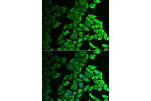 Immunofluorescence analysis of A549 cells using IL18BP antibody.