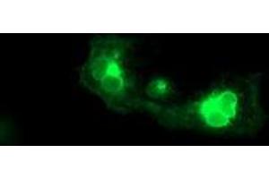 Anti-FGFR2 mouse monoclonal antibody (ABIN2454751) immunofluorescent staining of COS7 cells transiently transfected by pCMV6-ENTRY FGFR2 (RC217098). (FGFR2 antibody)