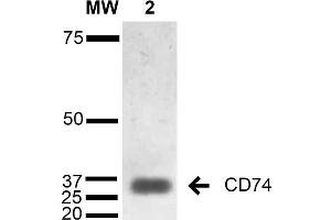 Western Blot analysis of Human Lymphoblastoid cell line (Raji) showing detection of 33-35 kDa CD74 protein using Mouse Anti-CD74 Monoclonal Antibody, Clone 1B8 . (CD74 antibody  (Atto 594))