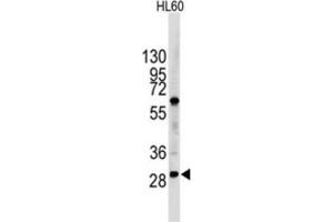 Western Blotting (WB) image for anti-Lin-28 Homolog B (LIN28B) antibody (ABIN2998297) (LIN28B antibody)