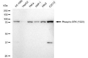 Western blotting analysis using Phospho-BTK (Y223) antibody (ABIN7797801).