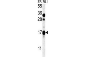 Western Blotting (WB) image for anti-CSAG Family, Member 2 (CSAG2) antibody (ABIN3002341) (CSAG2 antibody)