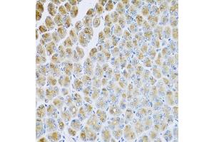 Immunohistochemistry of paraffin-embedded mouse stomach using AP1M2 antibody (ABIN5974667) at dilution of 1/100 (40x lens). (AP1m2 antibody)