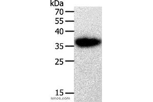Western blot analysis of A549 cell, using PLAUR Polyclonal Antibody at dilution of 1:450