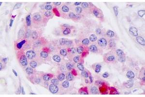 Anti-GLP-1 Receptor / GLP1R antibody IHC staining of human pancreas, islet of langerhans.