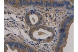 Detection of FBLN1 in Mouse Uterus Tissue using Monoclonal Antibody to Fibulin 1 (FBLN1) (Fibulin 1 antibody  (AA 399-578))