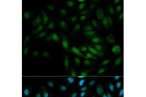 Immunofluorescence analysis of MCF-7 cells using MAPK7 Polyclonal Antibody (MAPK7 antibody)