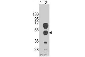 Western blot analysis of GATA4 (arrow) using rabbit GATA4 polyclonal antibody . (GATA4 antibody  (C-Term))