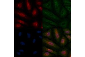 ABIN6259171 and ABIN6275708 staining  cells by IF/ICC.