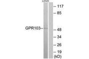 Western blot analysis of extracts from LOVO cells, using GPR103 Antibody. (QRFPR antibody  (AA 271-320))