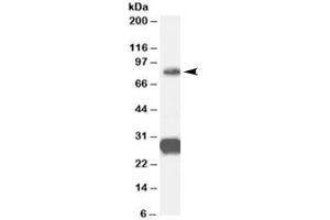 Western blot testing of human cerebellum lysate with FOXP2 antibody at 0. (FOXP2 antibody)