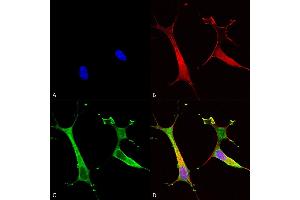 Immunocytochemistry/Immunofluorescence analysis using Mouse Anti-Copper Transporting ATPase 2 Monoclonal Antibody, Clone S62-29 (ABIN2485178). (ATP7B antibody  (AA 3-21) (PerCP))