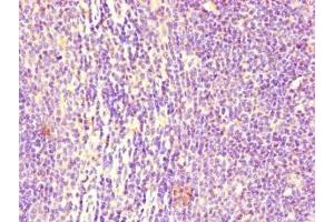 Immunohistochemistry of paraffin-embedded human lymph node tissue using ABIN7158541 at dilution of 1:100 (FCGR2B antibody  (AA 12-289))