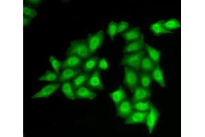 Immunofluorescence analysis of HeLa cells using SSRP1 antibody (ABIN6129536, ABIN6148492, ABIN6148494 and ABIN6217711). (SSRP1 antibody  (AA 1-300))