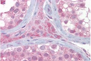 Immunohistochemistry with Testis tissue at an antibody concentration of 5µg/ml using anti-UBE2L3 antibody (ARP43023_P050) (UBE2L3 antibody  (Middle Region))
