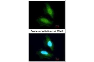 ICC/IF Image Immunofluorescence analysis of paraformaldehyde-fixed HeLa, using NPEPPS, antibody at 1:200 dilution. (NPEPPS antibody)