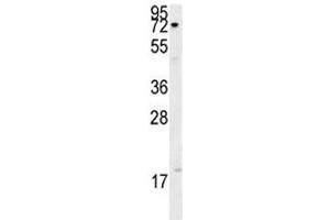 Western Blotting (WB) image for anti-X-Ray Repair Complementing Defective Repair in Chinese Hamster Cells 1 (XRCC1) (AA 407-435) antibody (ABIN3029645)