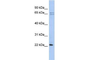 WB Suggested Anti-RPL18 Antibody Titration: 0. (RPL18 antibody  (N-Term))