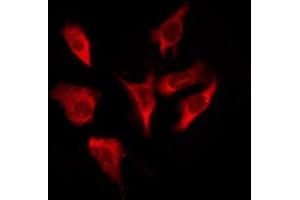 ABIN6276234 staining HT29 by IF/ICC. (VIPR1 antibody  (Internal Region))
