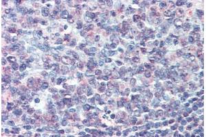 Anti-CD70 antibody  ABIN960751 IHC staining of human tonsil. (CD70 antibody  (N-Term))