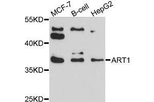 Western blot analysis of extracts of various cells, using ART1 antibody.