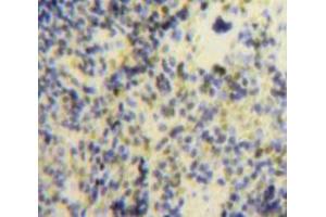 Used in DAB staining on fromalin fixed paraffin-embedded Spleen tissue (CXCL9 antibody  (AA 22-126))