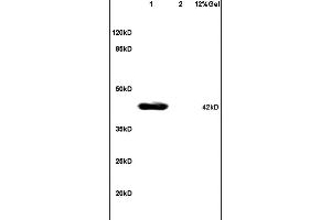 L1 mouse brain lysates L2 human colon carcinoma lysates probed with Anti - phospho-JNK1/2/3 (Thr183+Thr185) Polyclonal Antibody, Unconjugated at 1:200 in 4 ˚C. (JNK antibody  (pThr183, pTyr185))