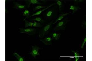 Immunofluorescence of purified MaxPab antibody to FOSL2 on HeLa cell. (FOSL2 antibody  (AA 1-326))