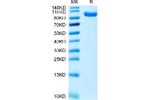 Human PTK7/CCK4 on Tris-Bis PAGE under reduced condition. (PTK7 Protein (AA 31-704) (His tag))