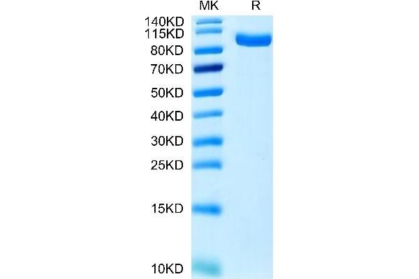PTK7 Protein (AA 31-704) (His tag)