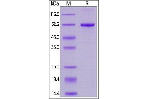 SDS-PAGE (SDS) image for Signal-Regulatory Protein alpha (SIRPA) (AA 31-370) (Active) protein (His tag) (ABIN6253574)