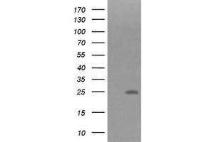 Image no. 1 for anti-Fibronectin Type III Domain Containing 4 (FNDC4) antibody (ABIN1498288) (FNDC4 antibody)