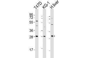 Western Blot at 1:2000 dilution Lane 1: T47D whole cell lysates Lane 2: KG-1 whole cell lysates Lane 3: human liver lysates Lysates/proteins at 20 ug per lane. (TIM3 antibody  (AA 167-194))