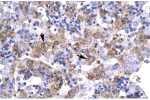 Rabbit Anti-POU1F1 Antibody Catalog Number: ARP31419 Paraffin Embedded Tissue: Human Liver Cellular Data: Hepatocyte Antibody Concentration: 4. (POU1F1 antibody  (C-Term))