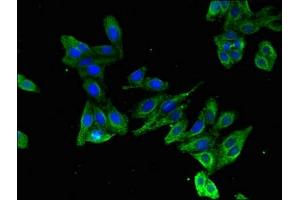 Immunofluorescent analysis of HepG2 cells using ABIN7157694 at dilution of 1:100 and Alexa Fluor 488-congugated AffiniPure Goat Anti-Rabbit IgG(H+L) (KRAB Box Domain Containing 4 (KRBOX4) (AA 1-98) antibody)