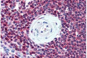 Human Spleen (formalin-fixed, paraffin-embedded) stained with SLC9A3R1 antibody ABIN305897 at 5 ug/ml followed by biotinylated goat anti-rabbit IgG secondary antibody ABIN481713, alkaline phosphatase-streptavidin and chromogen. (SLC9A3R1 antibody)