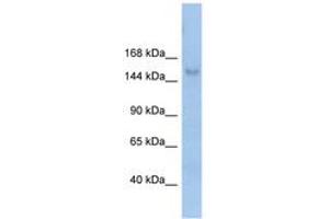 Image no. 1 for anti-Mov10l1, Moloney Leukemia Virus 10-Like 1 (MOV10L1) (AA 71-120) antibody (ABIN6742690) (MOV10L1 antibody  (AA 71-120))