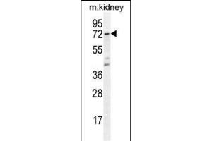 CYP5A1 Antibody (Center) (ABIN656016 and ABIN2845391) western blot analysis in mouse kidney tissue lysates (35 μg/lane).